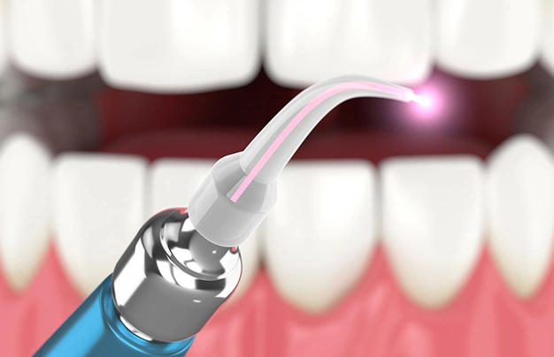 laser bacterial reduction long beach ca