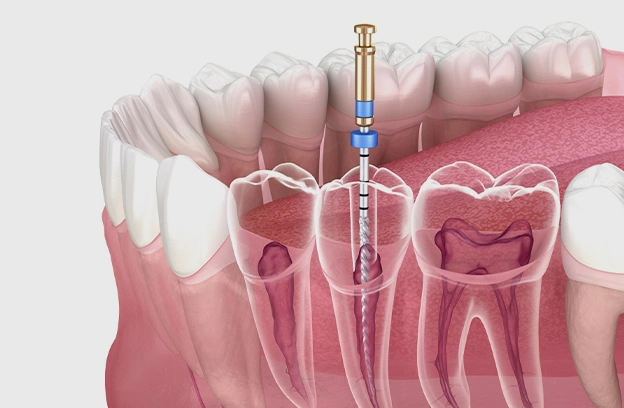 periodontal disease treatment