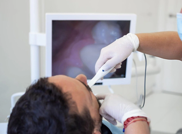 intraoral camera