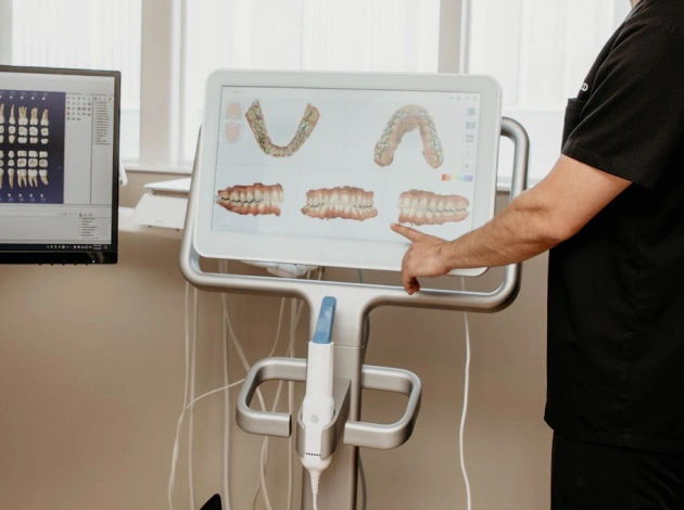 itero digital intraoral scanner