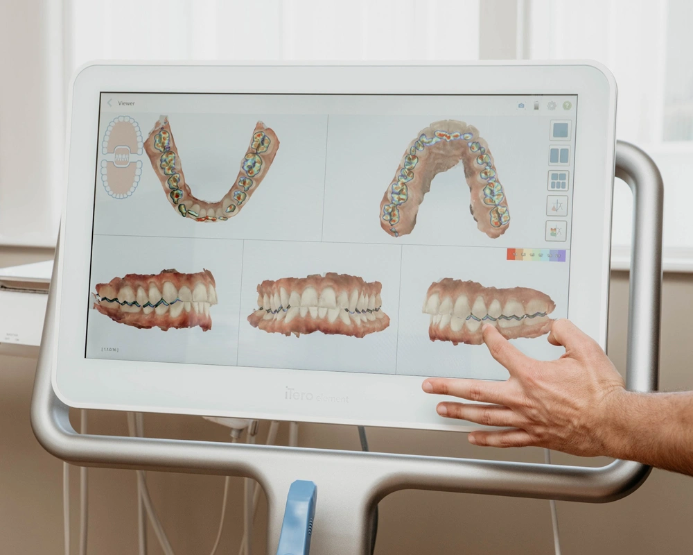 3d scanning