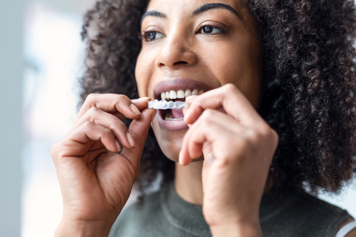 Timeline expectations for invisalign procedure