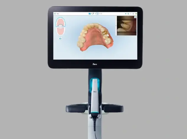 itero digital intraoral scanner