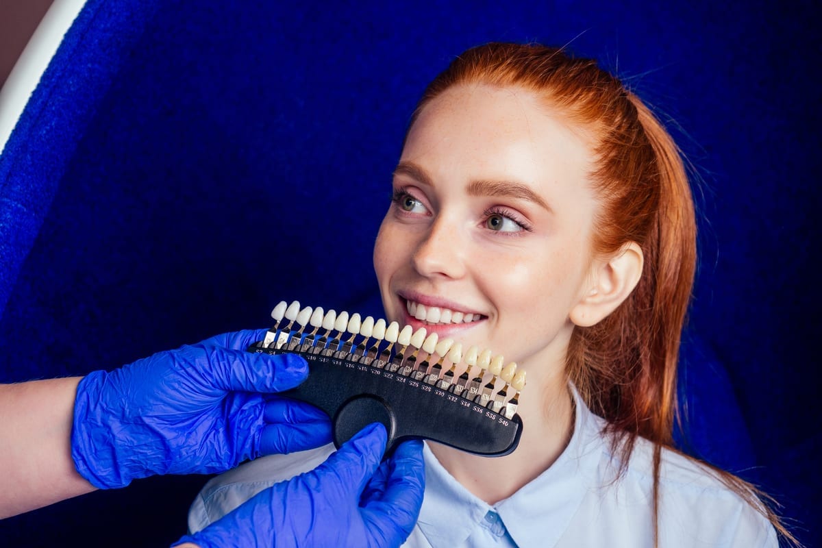 Veneers in Rossmoor